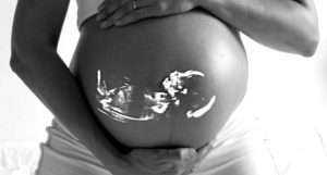 תכנון לידה - הכנה ללידה