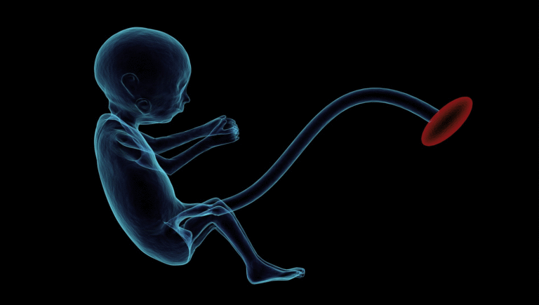 בדיקת אולטרסאונד בהריון